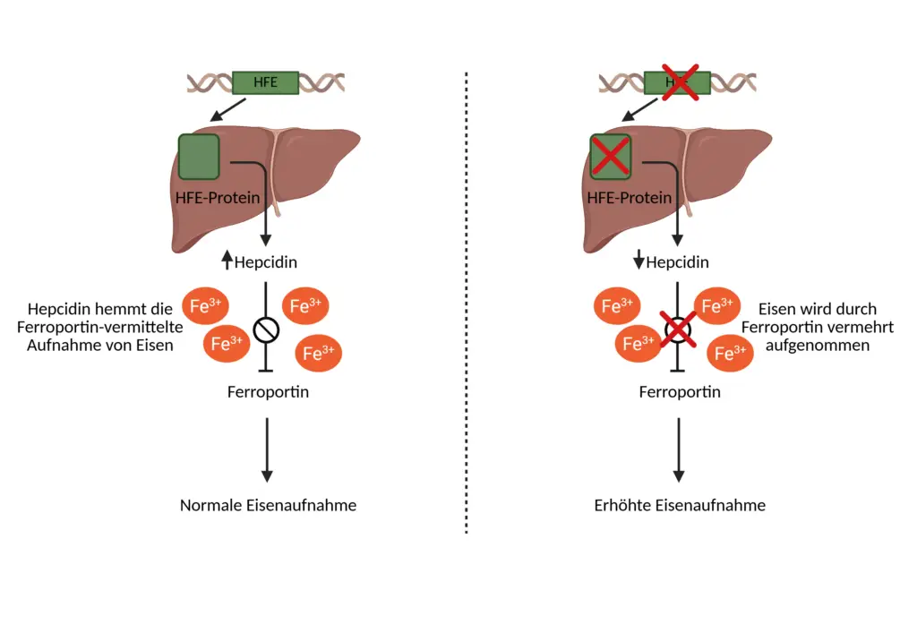 grafische Darstellung wie das HFE Gen die Aufnahme von Eisen beeinflusst.